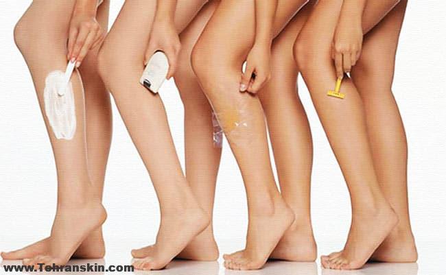 از بین بردن دائمی موهای پا