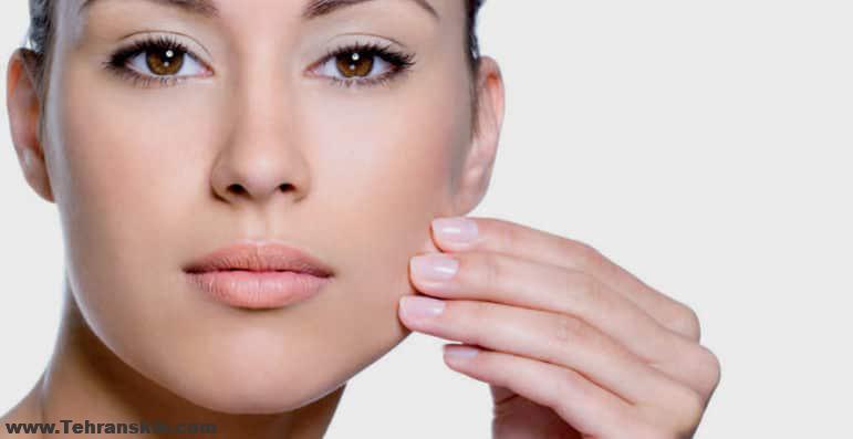 لیزر موی زائد صورت