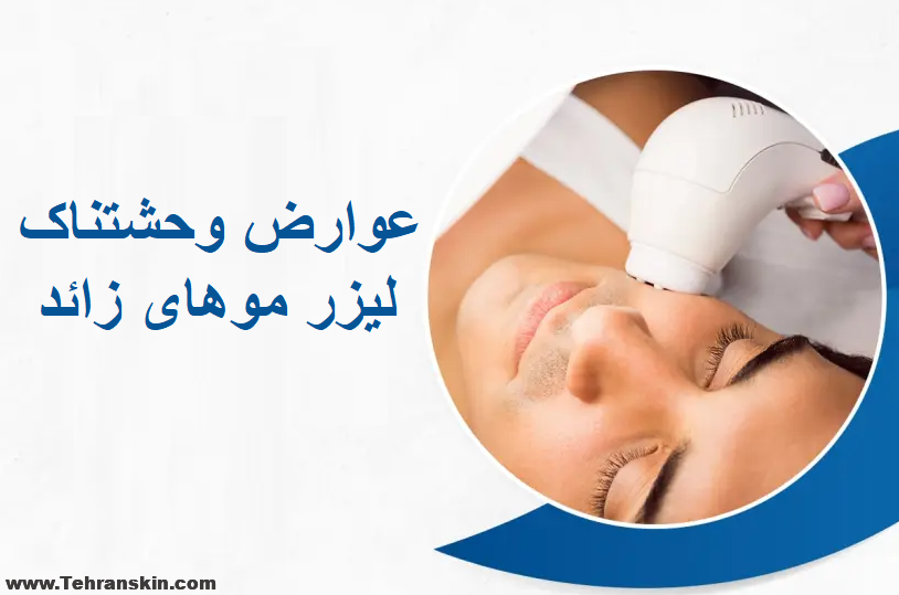 عوارض وحشتناک لیزر