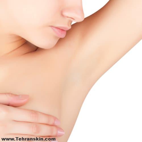 لیزر موهای زیر بغل