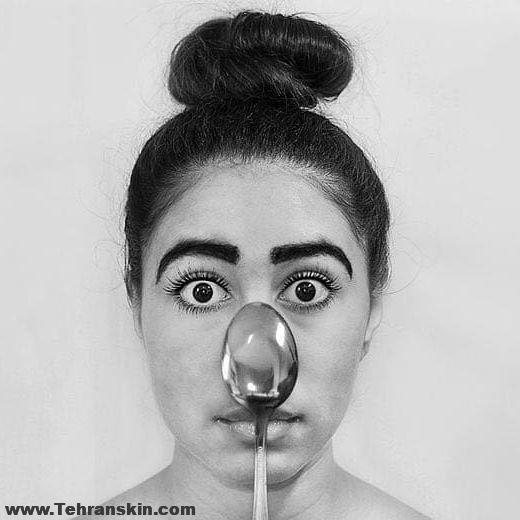 عمل زیبایی بینی های گوشتی و پهن | مدل بینی عمل شده طبیعی| دکتر بینی