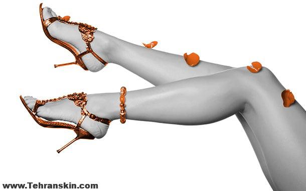 لیزر موهای زائد