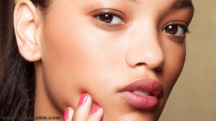 تخفیف میکرودرم ابریژن