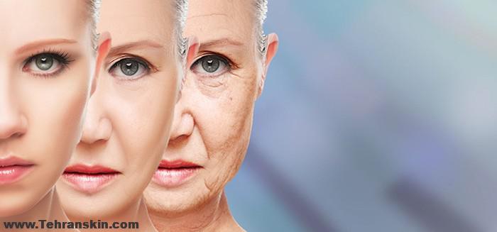 تزریق چربی صورت