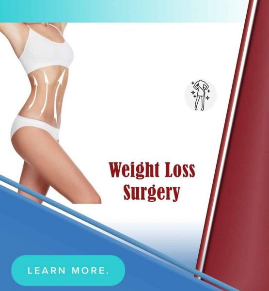 weight loss surgery in tehran iran