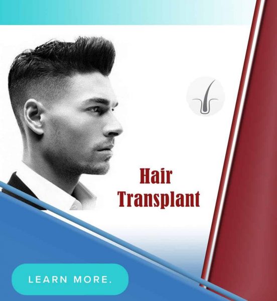 hair tranplant in iran
