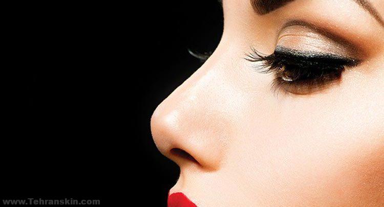 جراحی رینوپلاستی در چه مواردی انجام می شود؟