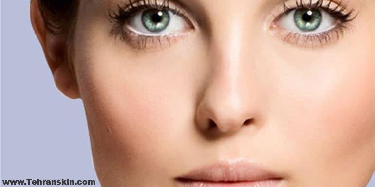 عکس های قبل و بعد رینولاستی | 4 دلیل برای اینکه رینوپلاستی بکنید!