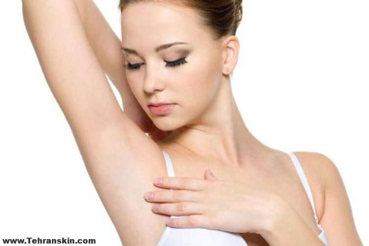 لیزر موهای زائد