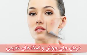 رفع جای زخم و اسکار