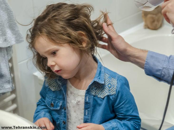 علل پزشکی ریزش مو در کودکان | علل ریزش مو در نوزادان