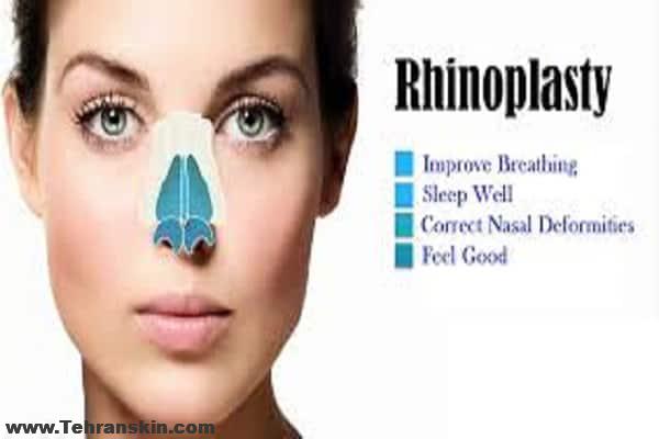 رینوپلاستی برای آپنه خواب | خروپف کردن را با رینوپلاستی درمان کنید!