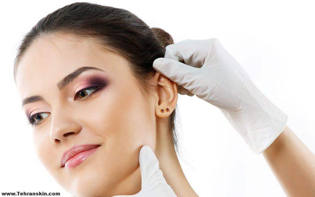 جراحی زیبایی گوش بزرگسالان روش های جراحی زیبایی گوش توسط بهترین جراح