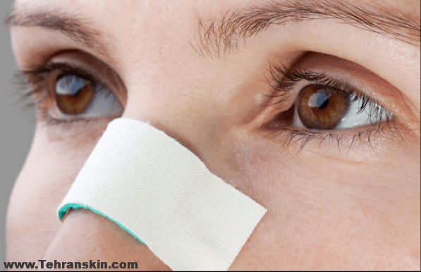 ترفند هایی برای کوچک نشان دادن بینی | روشهای اینترنتی برای کوچک نشان دادن بینی