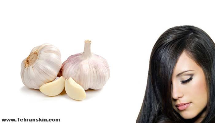 خواص سیر برای جلوگیری از ریزش مو و رشد موها | انواع ماسک مو با سیر