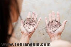 روش های اشتباه برای جلوگیری از ریزش موها|رازهای نگفته در باره زیبایی و سلامت موها