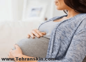 لیزر موهای زائد و بارداری