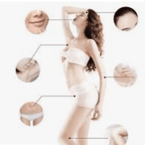 لیزر موهای زائد