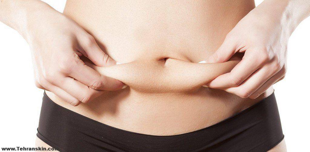 پیکرتراشی در تهران