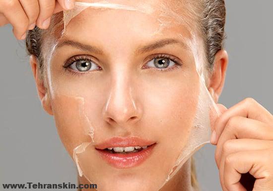 جوانسازی صورت