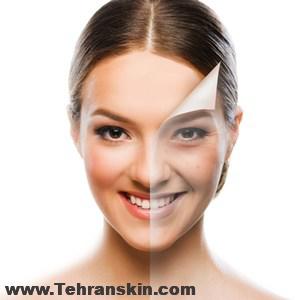 جوانسازی پوست