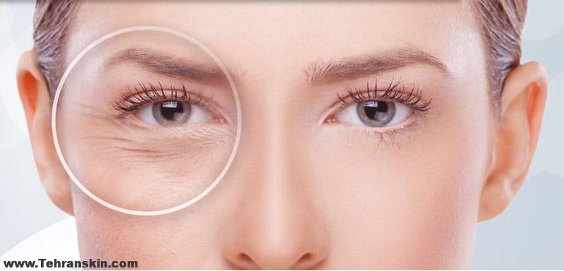 متخصص بلفاروپلاستی در تهران