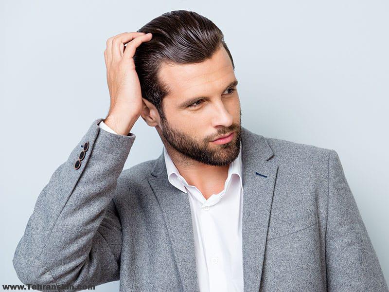 6 راه حل برای کنترل ریزش موها | بهترین درمان ریزش مو| بهترین دکتر کاشت مو