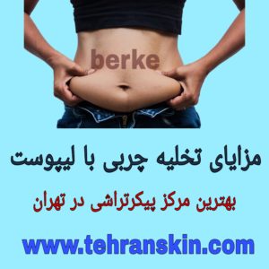 مزایای لیپوست نسبت به بقیه روش ها