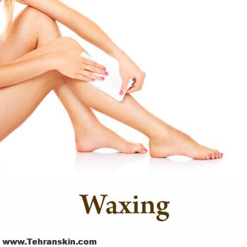 برطرف کردن موهای زائد