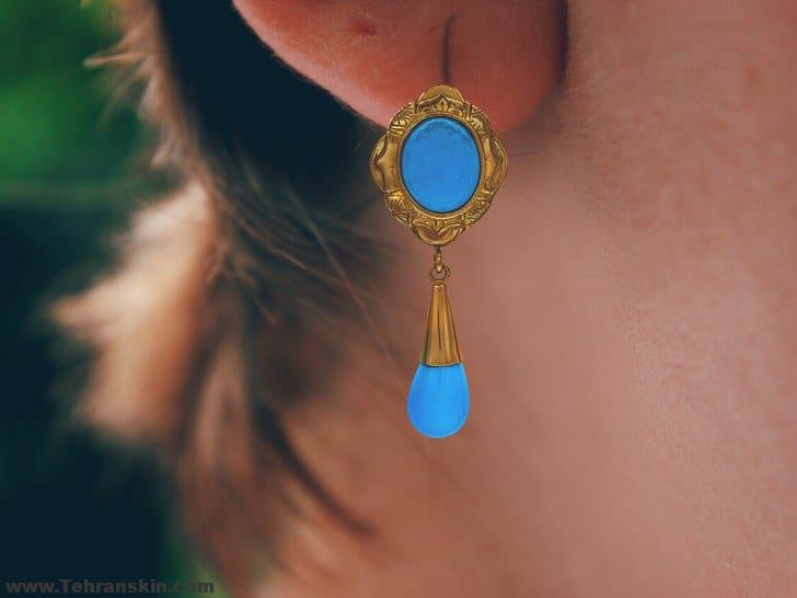 ترمیم پارگی سوراخ گوش | ترمیم نرمه گوش | فیلم جراحی پلاستیک نرمه گوش