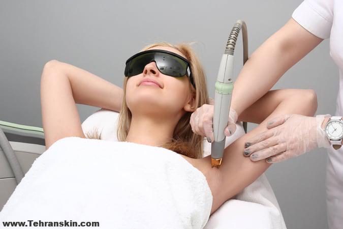 تجربه ی لیزر