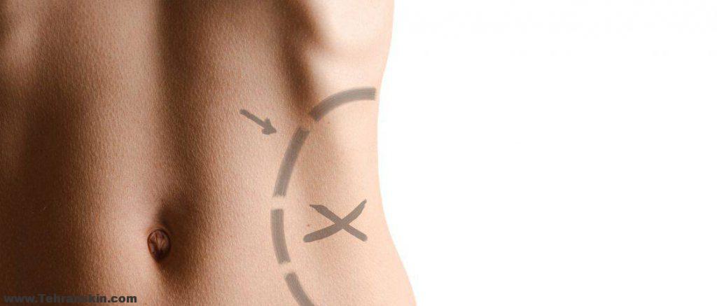 تصاویر پیکرتراشی