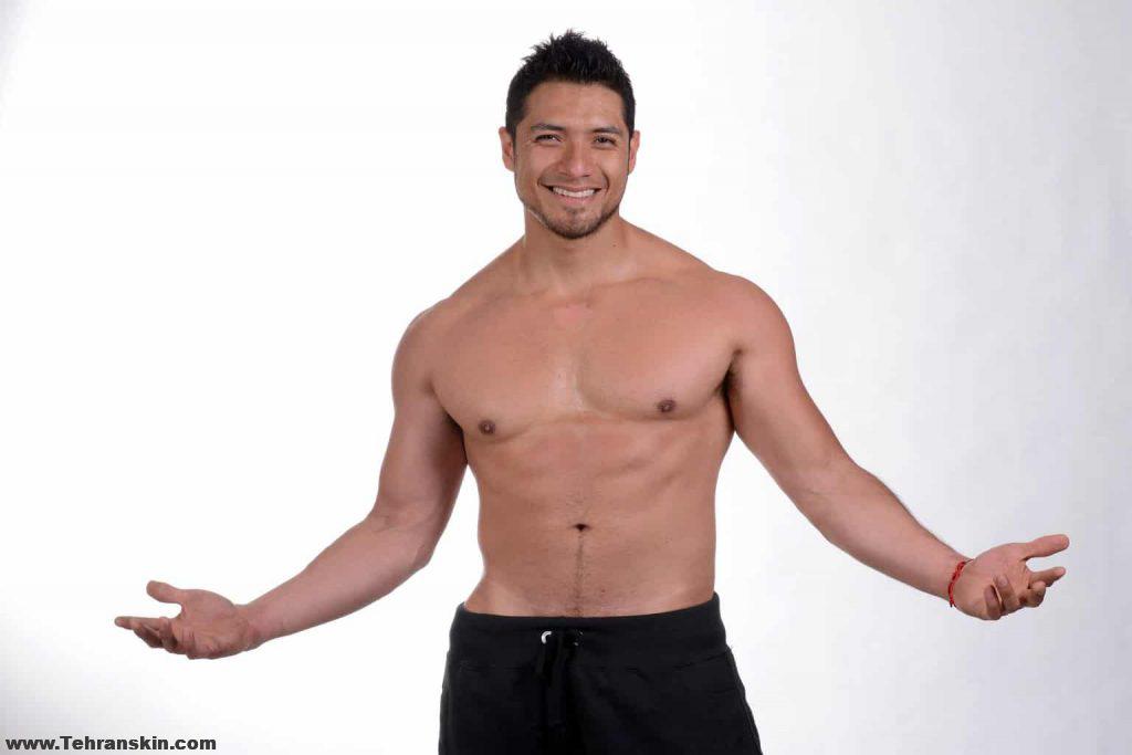 لیزر موی آقایان