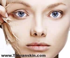 رفع چین و چروک صورت با بوتاکس