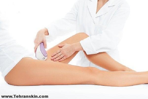 لیزر موهای زائد بیکینی