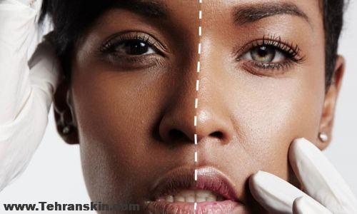 بهترين روش براي روشن كردن پوست