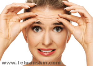 هناك نوعان من التجاعيد: التجاعيد الديناميكية والخطوط والتجاعيد الدقيقة.