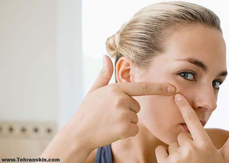 بهترین قرص زیبایی پوست