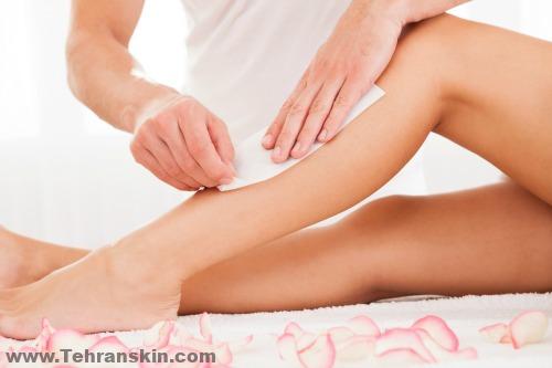 از ریشه کندن مو