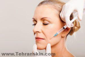 تستخدم إبرة رفيعة جدًا لحقن كميات صغيرة من توكسين البوتولينوم في عضلات معينة.