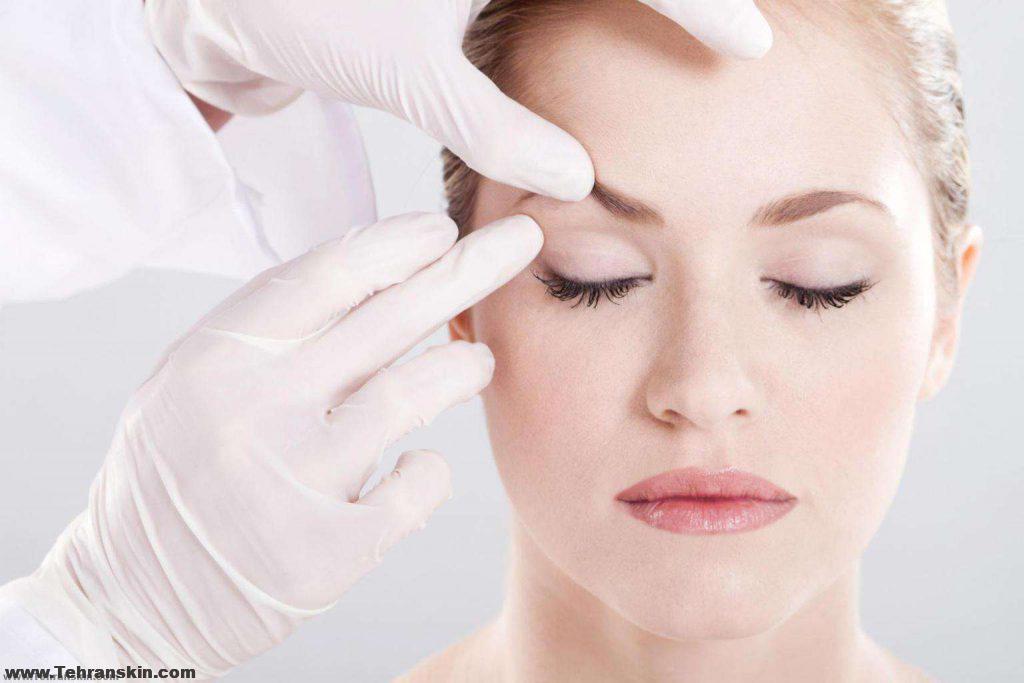 جراحة الجفن أو رأب الجفن هي إجراء جراحي لتحسين مظهر الجفون.