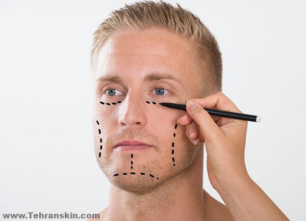 إذا كنت تخطط لجراحة الوجه أو جراحة الرقبة ، فسيقوم طبيبك بتقييم كامل منطقة الرأس والوجه
