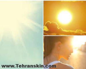 مراقبت از پوست پس از لیزر موهای زائد