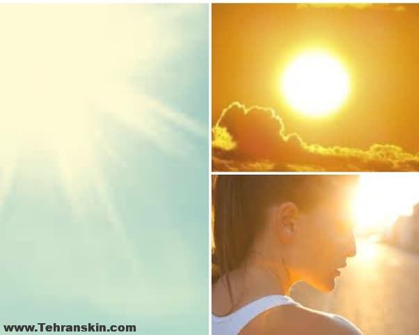 مراقبت از پوست پس از لیزر موهای زائد