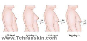 ل لديك صور قبل وبعد يمكنني النظر إليها في هذا الإجراء وما هي النتائج المعقولة بالنسبة لي