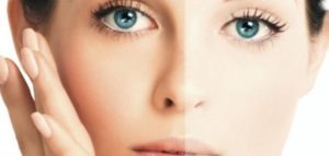 قد يلاحظ بعض الأشخاص تغيرات طفيفة في اللون في المنطقة المعالجة من الجلد