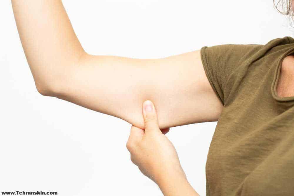 ما هو براکیوبلاستی أو عملية شد الذراع ؟