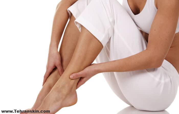 لیزر دائمی موهای زائد