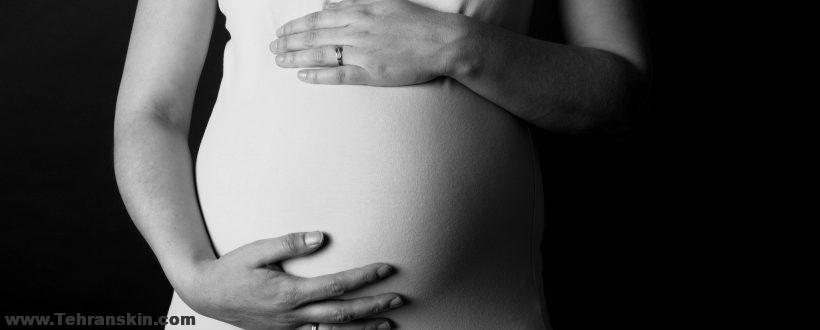 تاثیر لیزر موهای زائد بر باروری