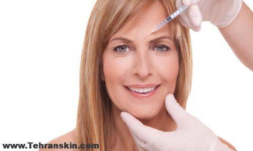 تخفیف بوتاکس در تهران